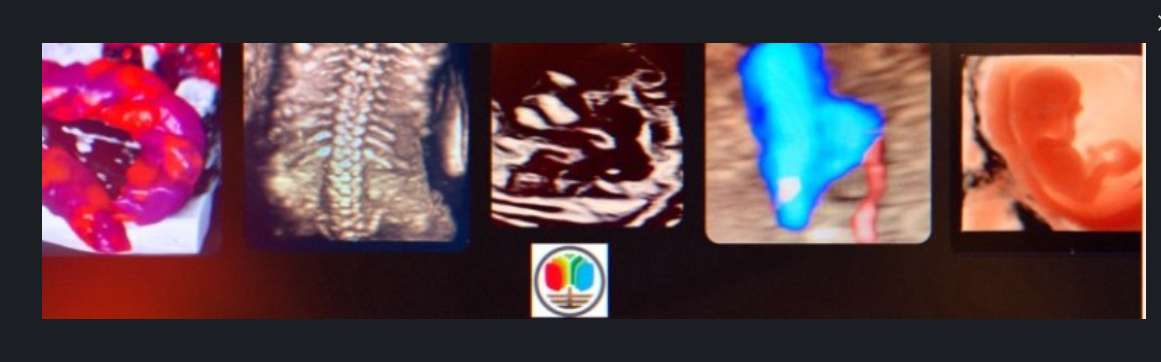 Examples of fetal cardiac ultrasound imaging